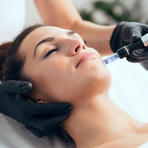 Microneedling mit Exosomen